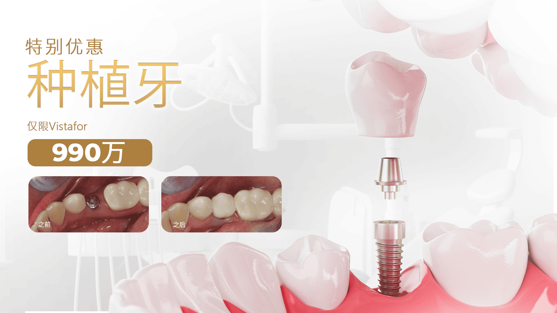 Smile Lab Hero Slide 2