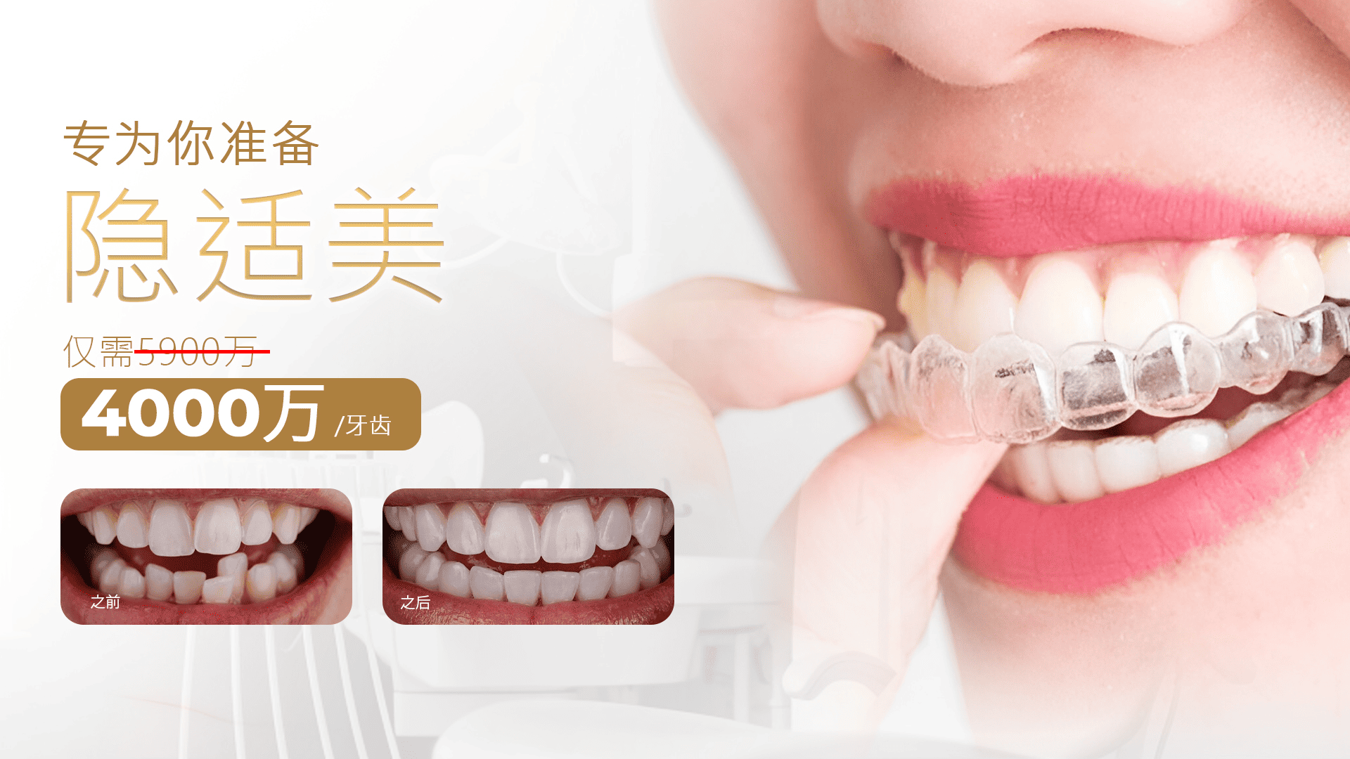 Smile Lab Hero Slide 3